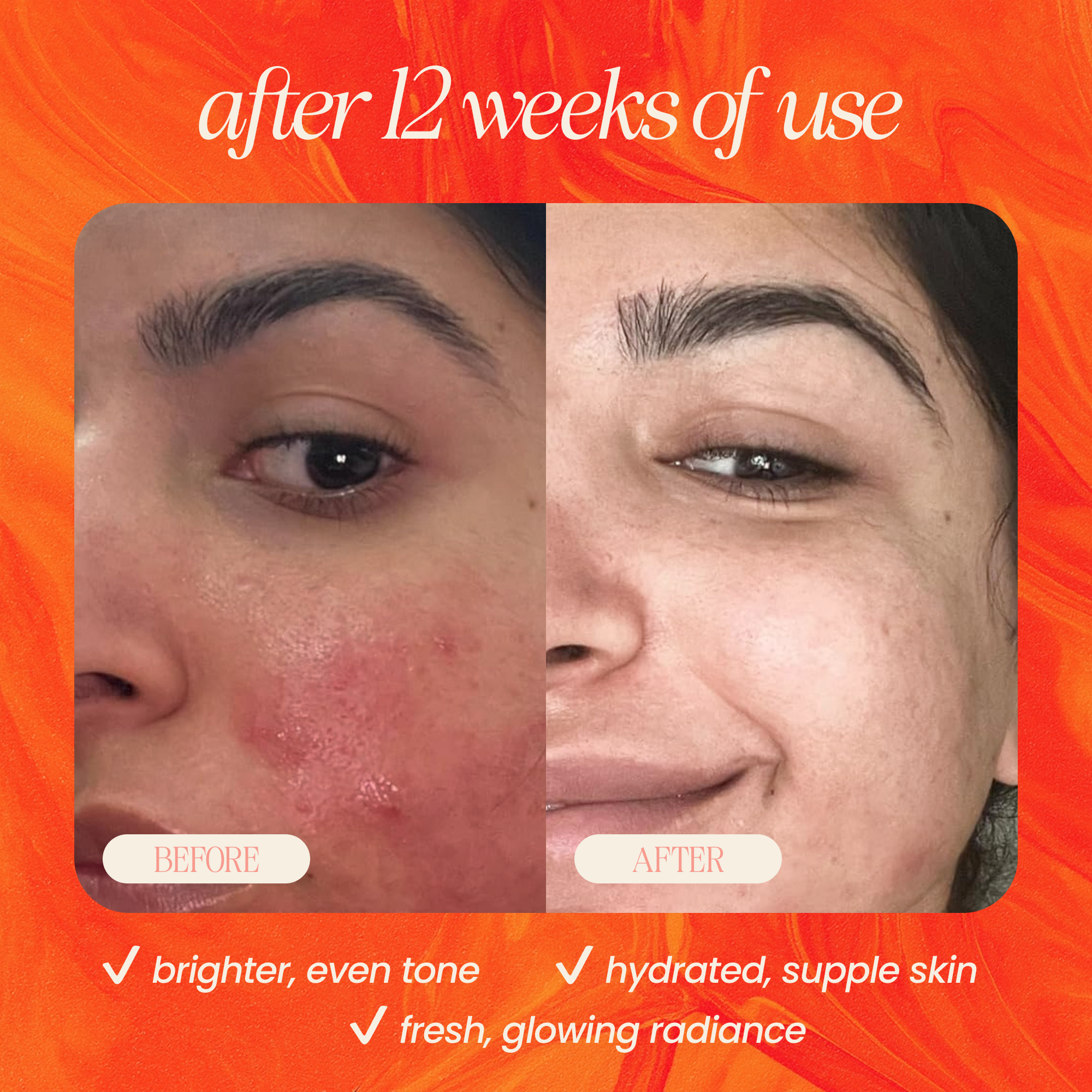 VIAI Beauty – wholesale Facial serum/concentrate – Pineapple & Rosehip Vitamin C Serum1