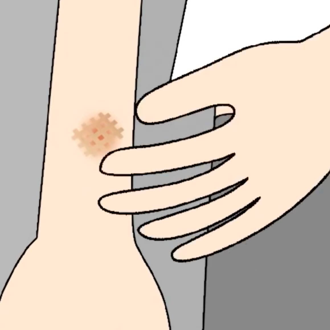 Moskinto: Original Itch-Relief Patch & 14hr Insect Repellent - Wholesale Itch Ointment/Cream - Moskinto 42ct: The Original Itch Relief Patch7