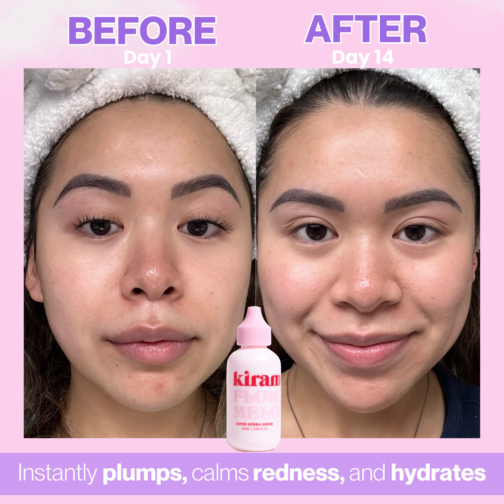 Kiramoon - Wholesale Facial Serum/Concentrate - Flowermelon Super Hydrating Serum2