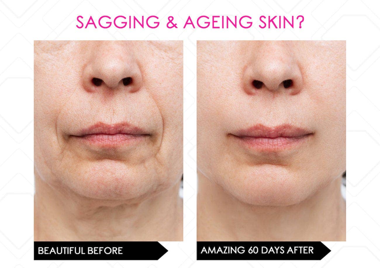 Mirenesse - Wholesale Electronic Skincare Device - LED Multi Light Therapy Mask, Electronic Skincare Device18