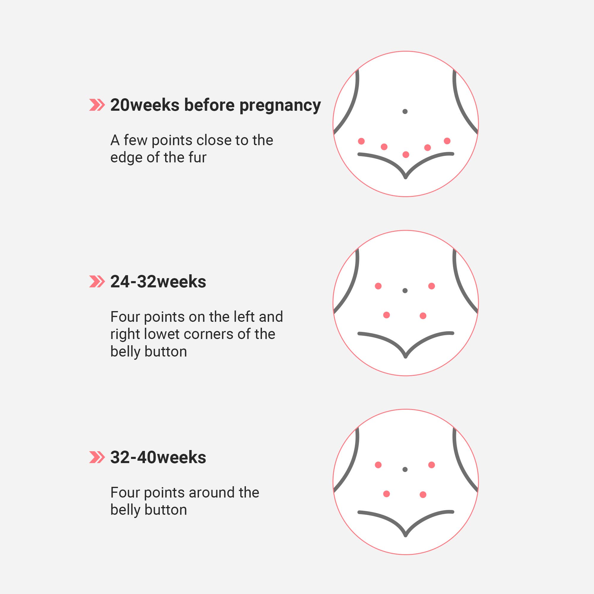 Vastmedic - Wholesale Babyfoon - SpringBud FD-400B prenatale Doppler voor hartslagmonitoring7