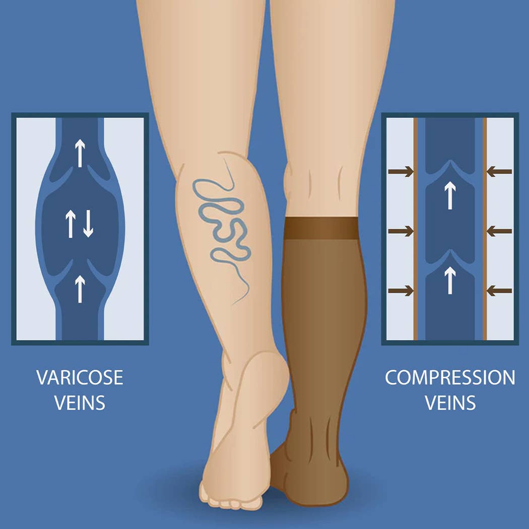 Curvy Fix - Wholesale Socks - Women's - Mid Calf Plus Size Compression Socks - 20-30 mmHg7