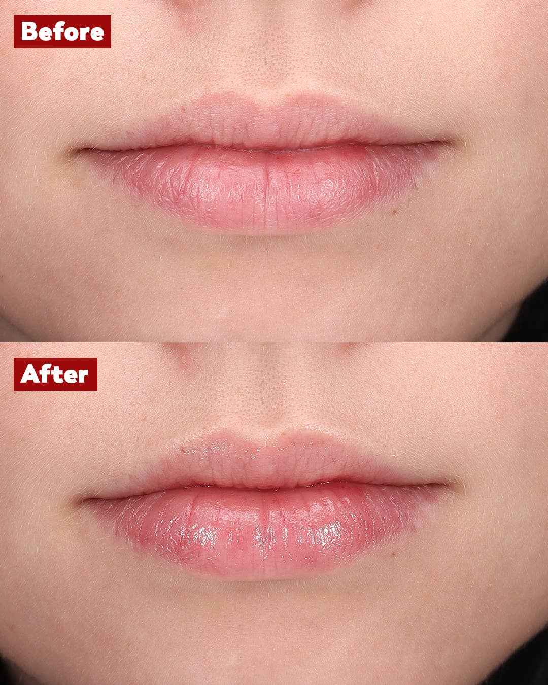 Trew Cosmetic - Venta al por mayor Voluminizadores de labios - Bálsamo Voluminizador 100 % Natural: Ácido Hialurónico y Colágeno1