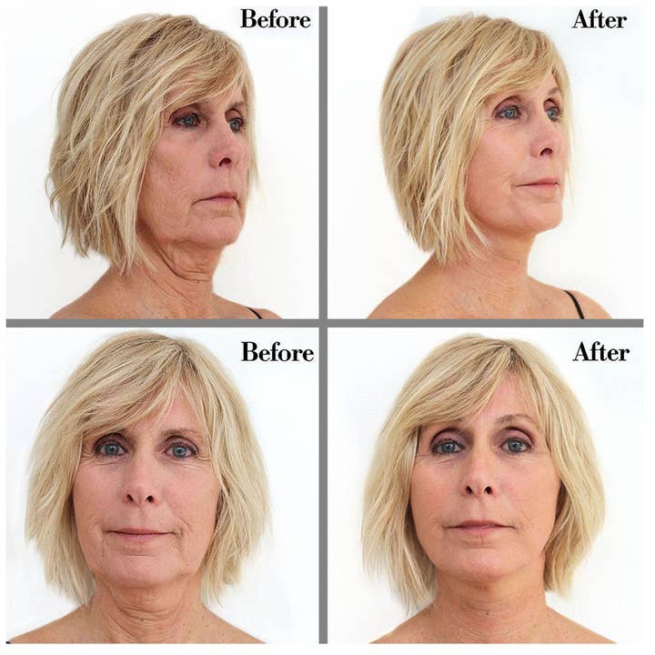 Bring It Up - Wholesale Fashion/Breast Tape - Women's - Instant Face Lift Tape Kit