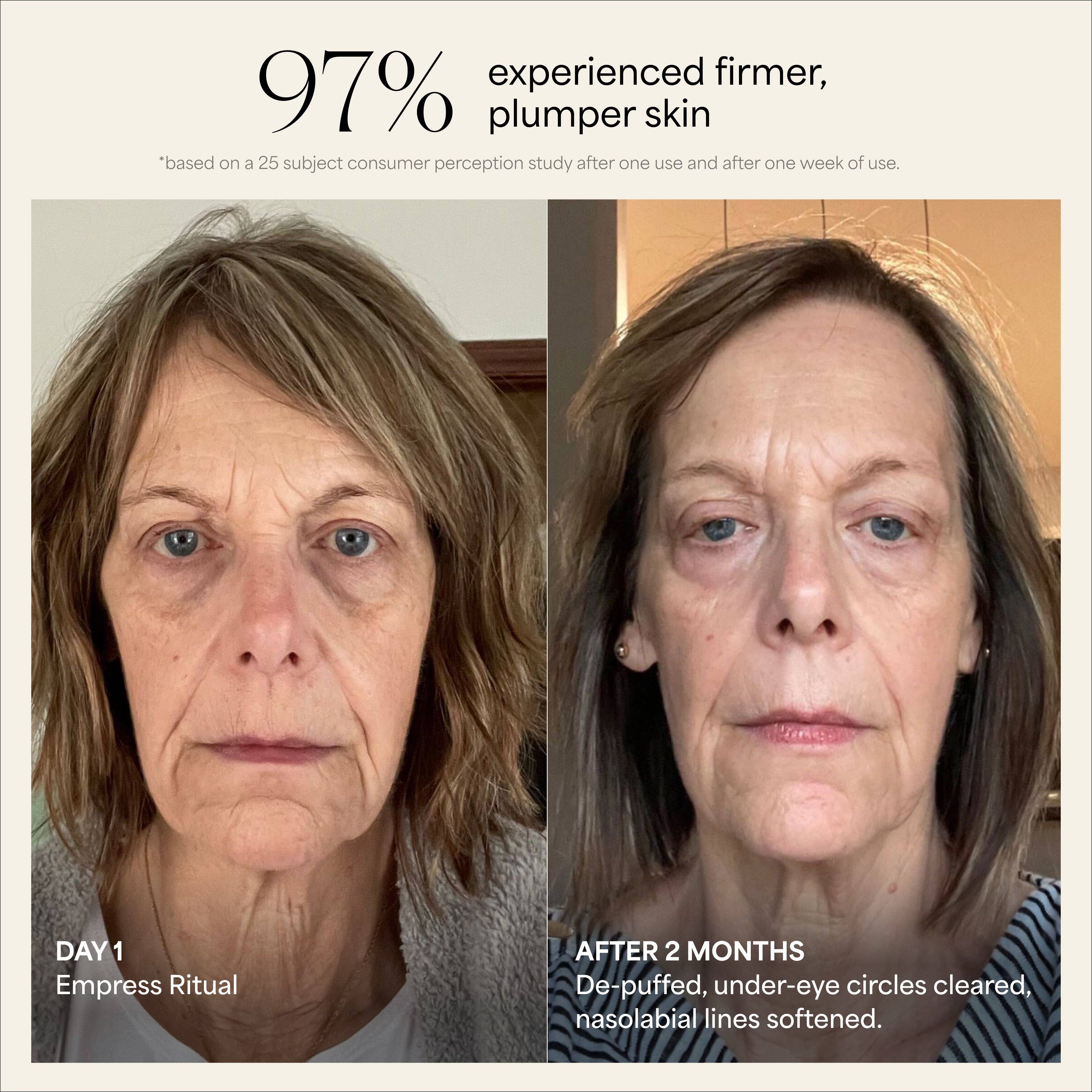 Wildling – Engroshandel Gua Sha – Empress Stone ansigtsværktøj3