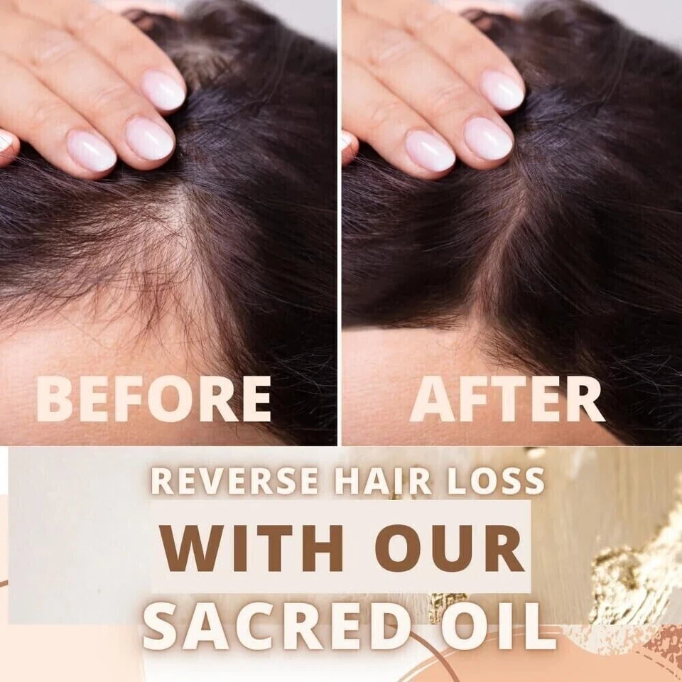 Au Natural Organics – wholesale Hair oil – Bulk Pure Batana Oil for Hair Growth Supplier Honduras 1 ltr2