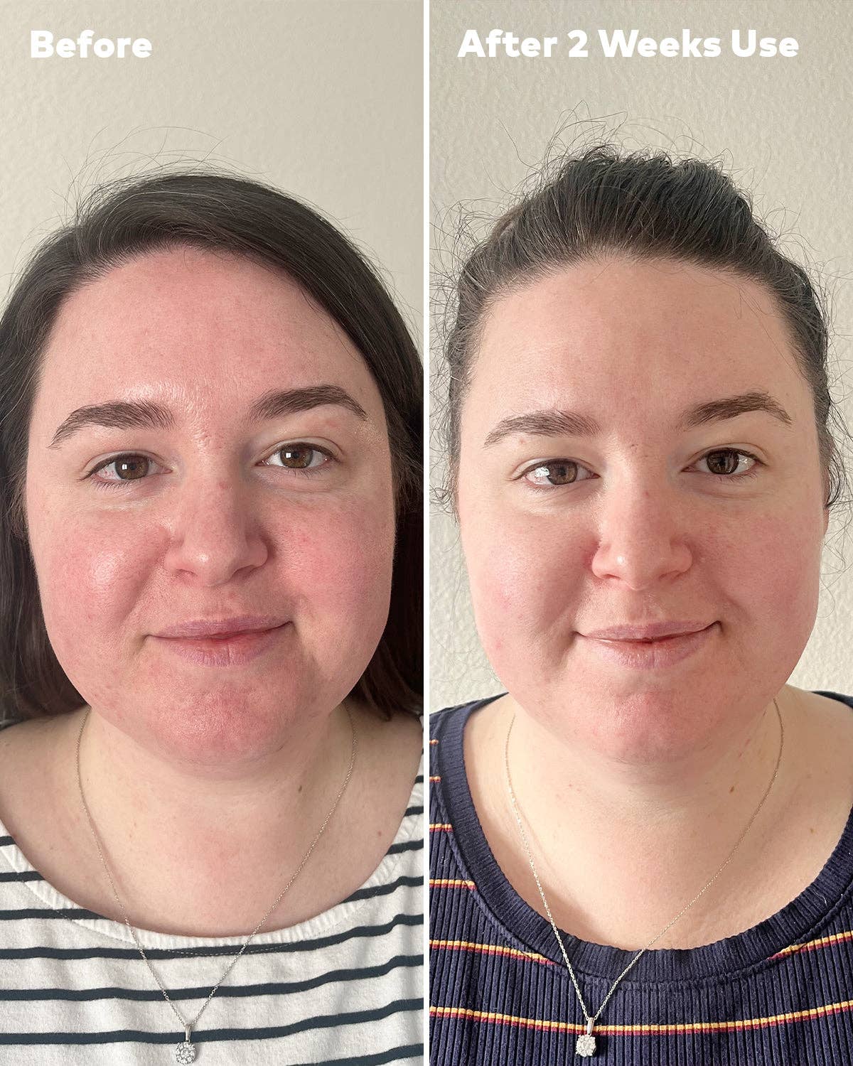 The Original MakeUp Eraser – Großhandel Make-up-Entferner – Silver-Infused Mini PRO MakeUp Eraser für zu Akne neigende Haut7