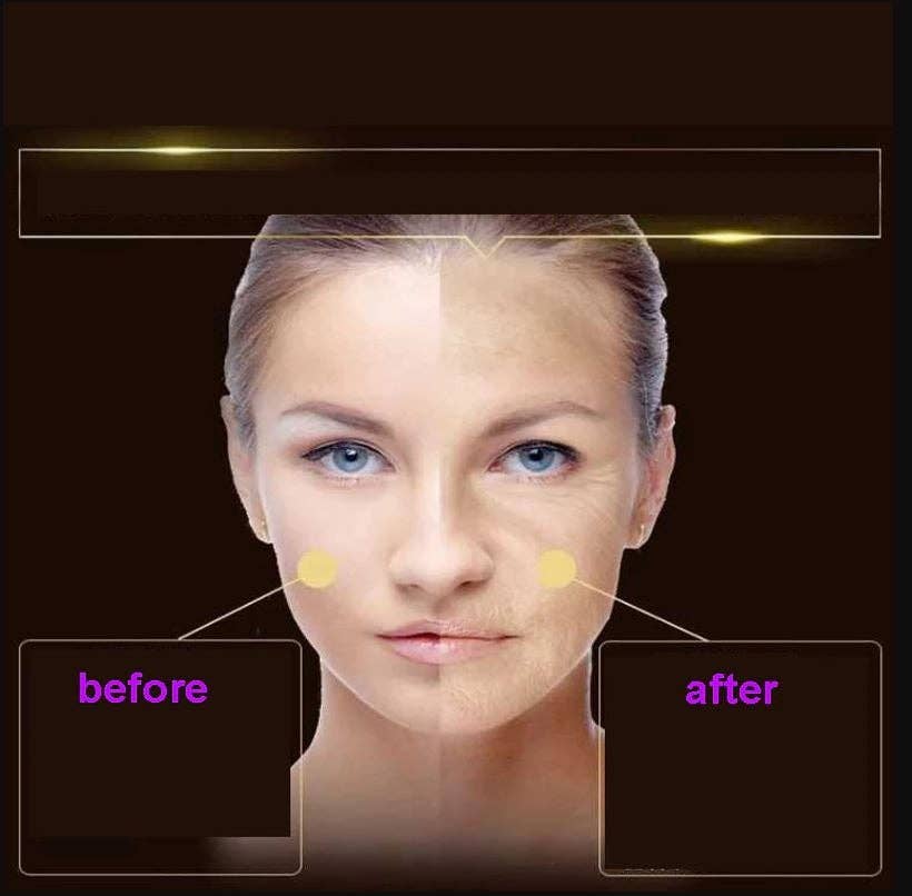 VIGOR - Wholesale Facial Serum/Concentrate - EGF space-time capsule (Epidermal Growth Factor)1