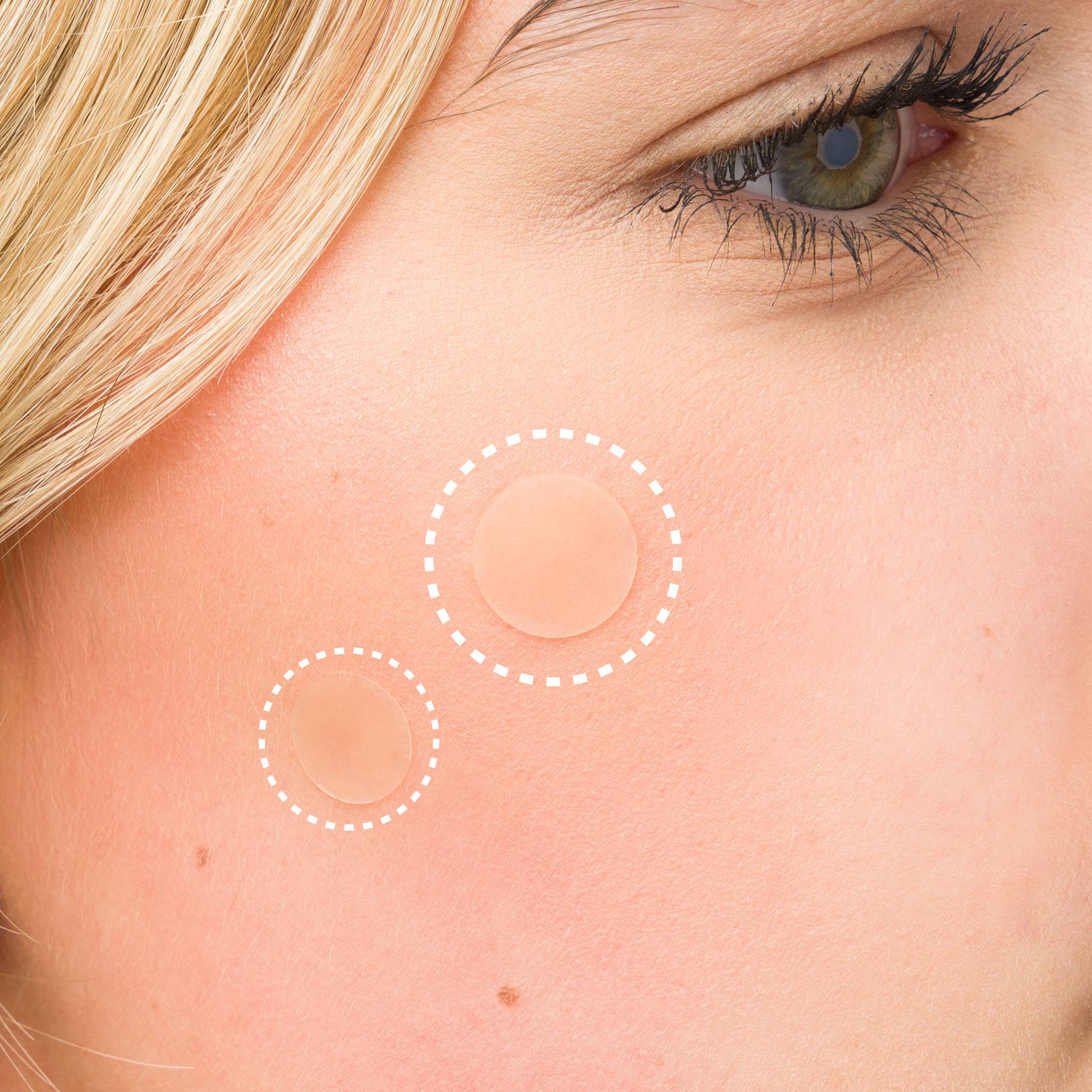 Soinvogue – wholesale Acne/hydrocolloid patch – Brushworks Breakout Barrier Hydrocolloid Spot Patches - 26pc8