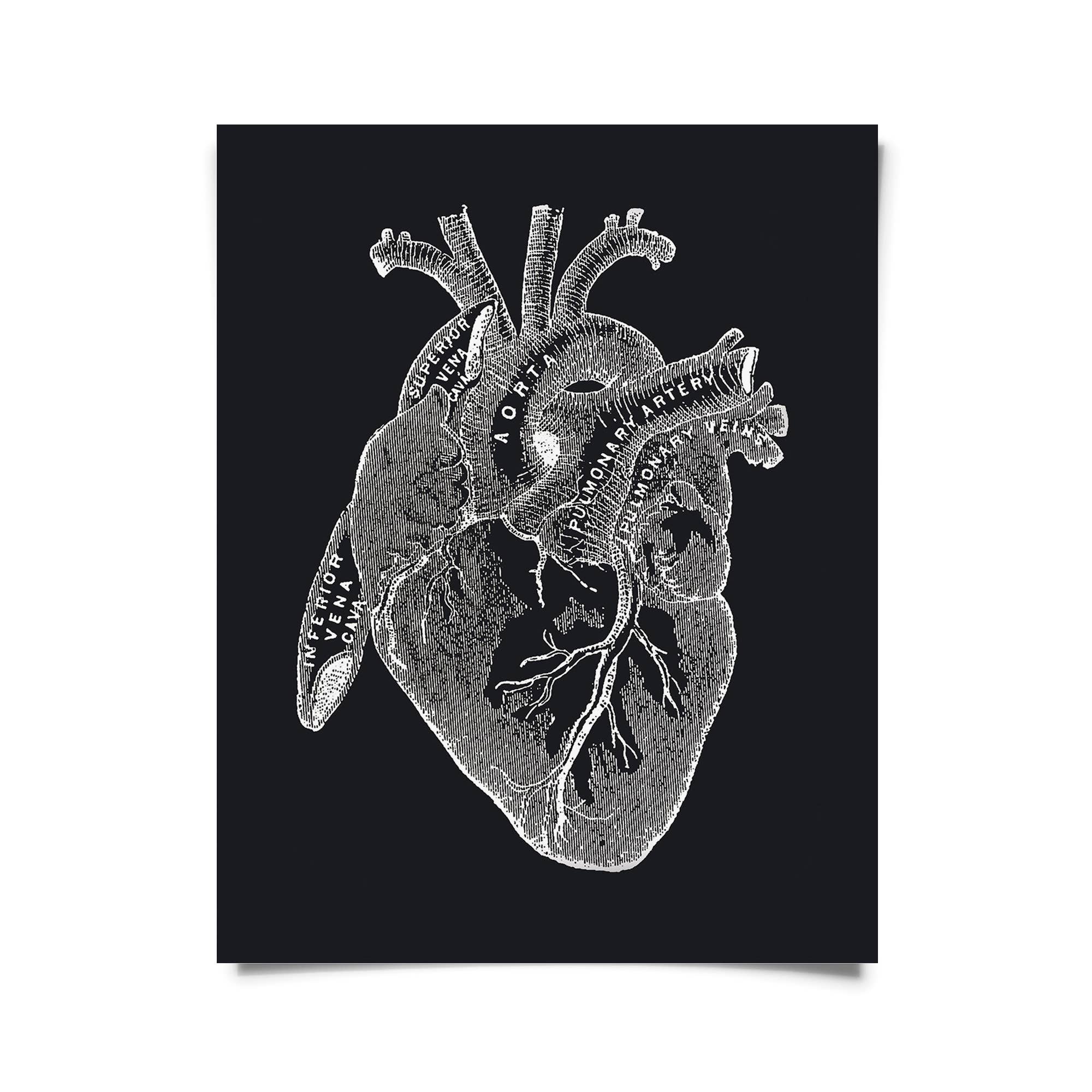 Curious Prints - Wholesale Art Print - Vintage Anatomy Heart Diagram Black Print w/ optional frame