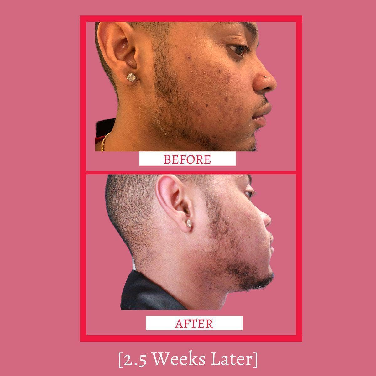 Gymsegbe - Wholesale Facial Toner - Dynamic Toner3