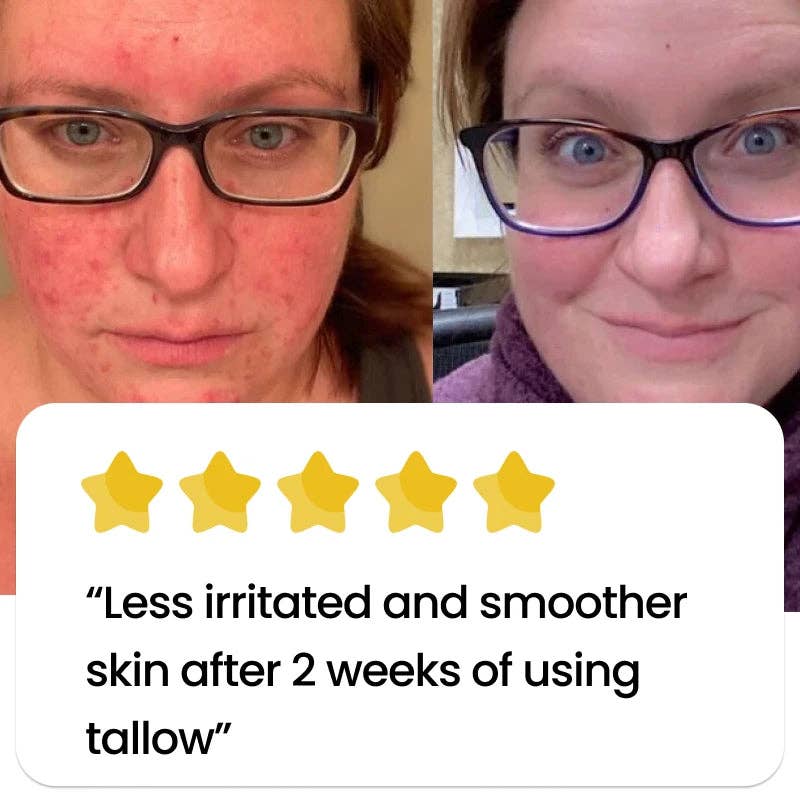 The Primal - Wholesale Body Balm/Butter - Unscented Whipped Tallow Balm (Face & Body)7