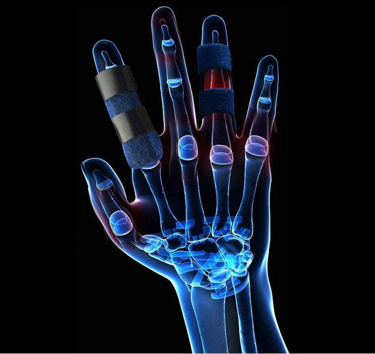 VIGOR - Wholesale Press-On/Fake Nails - Premium Quality Compression Finger Splints with Flexible Bui24