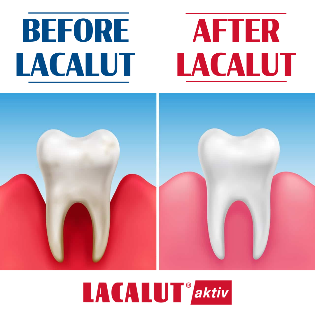 LACALUT - WHOLESALE - Wholesale Toothpaste - LACALUT Aktiv 75ml - RRP $13.9522