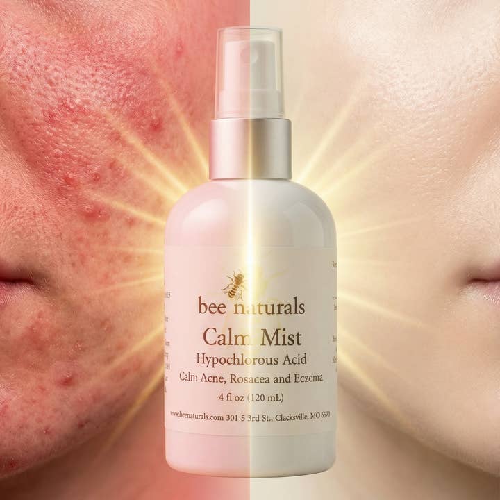 Bee Naturals - Wholesale Face & Body Mist/Water - Calm Mist - Hypochlorous Acid Spray for Face | Calms Acne, Rosacea & Eczema | Sensitive Skin Facial Toner Mist | Fragrance-Free, Dermatologist Tested | 4 fl oz4