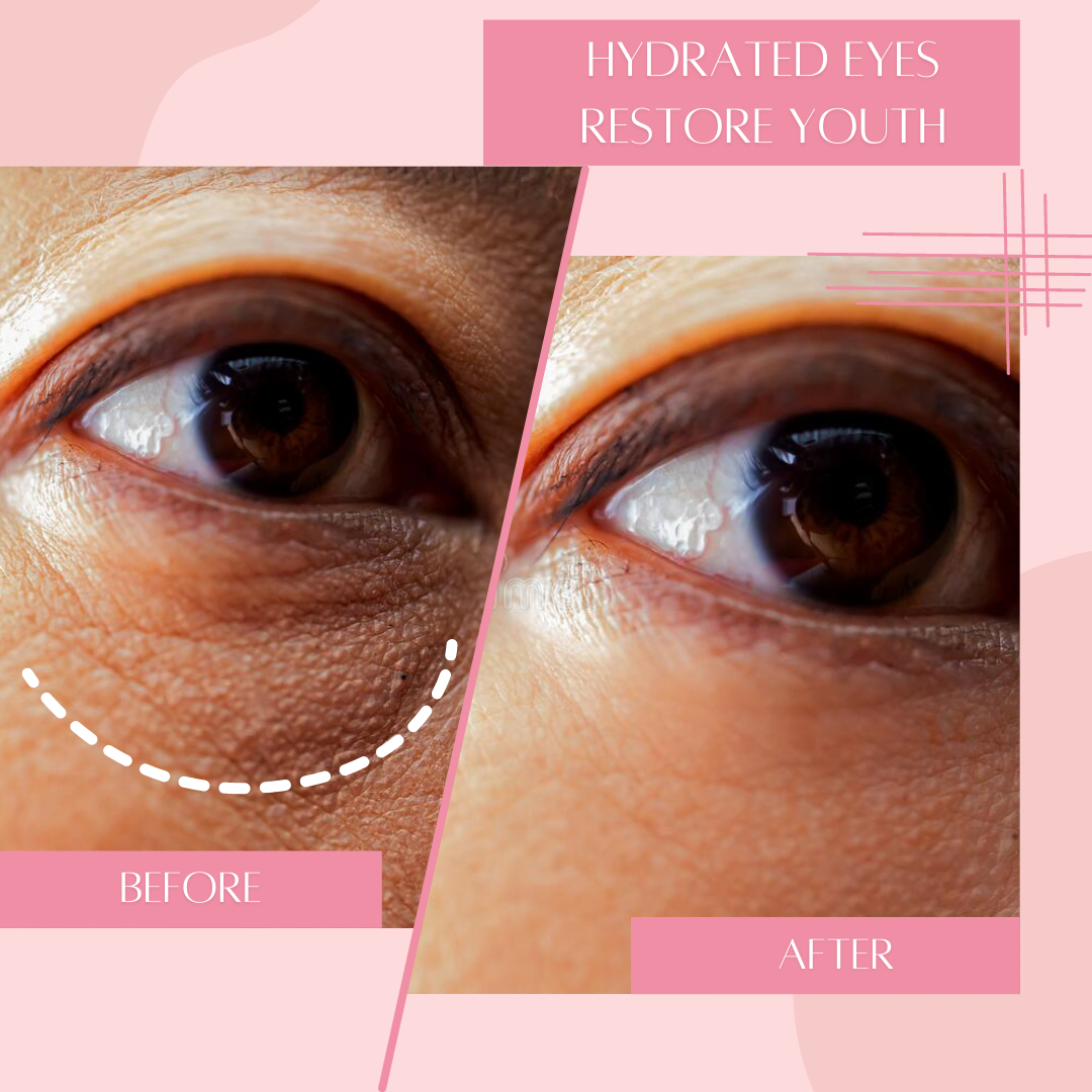 Dreambox Beauty - Wholesale Eye Treatment Mask - Hydrating Under Eye Mask [Reusable]5