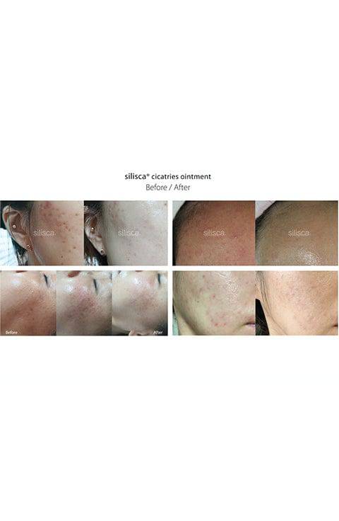 Palace Beauty Galleria - Wholesale Facial Moisturizer - SILISCA RH-OLIGOPEPTIDE-1 Cream8