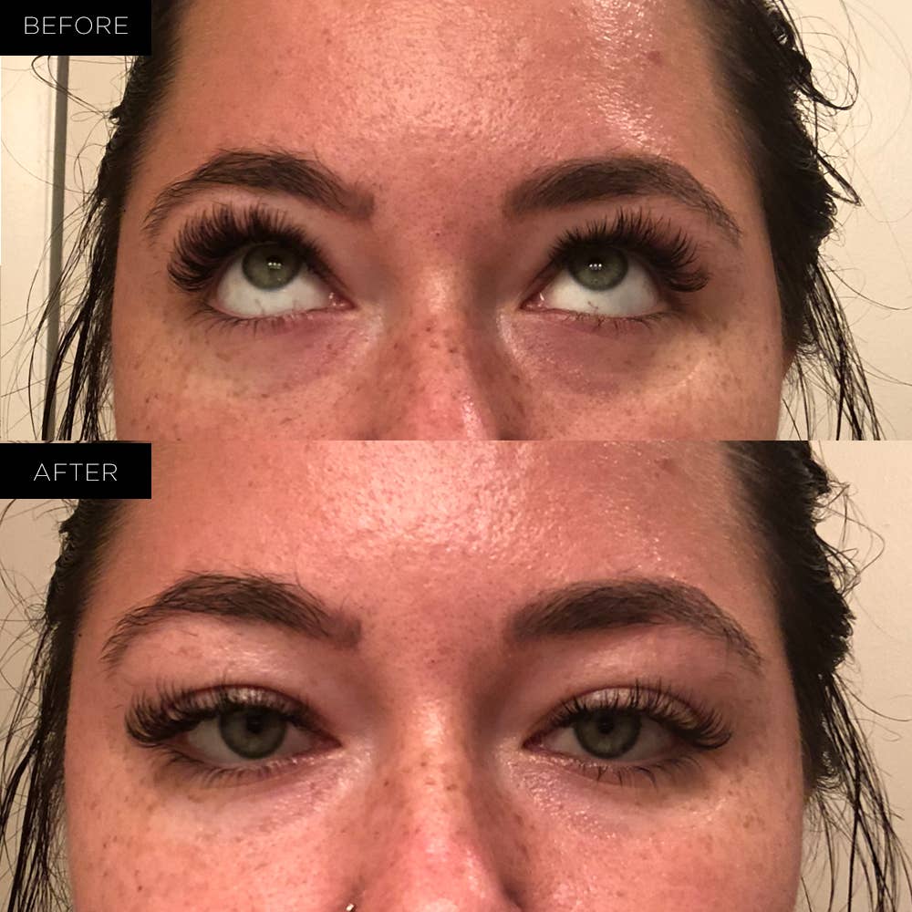 Endure Beauty – wholesale Eye treatment mask – Endure Under Eye Therapy Gel Pads - Renewing2