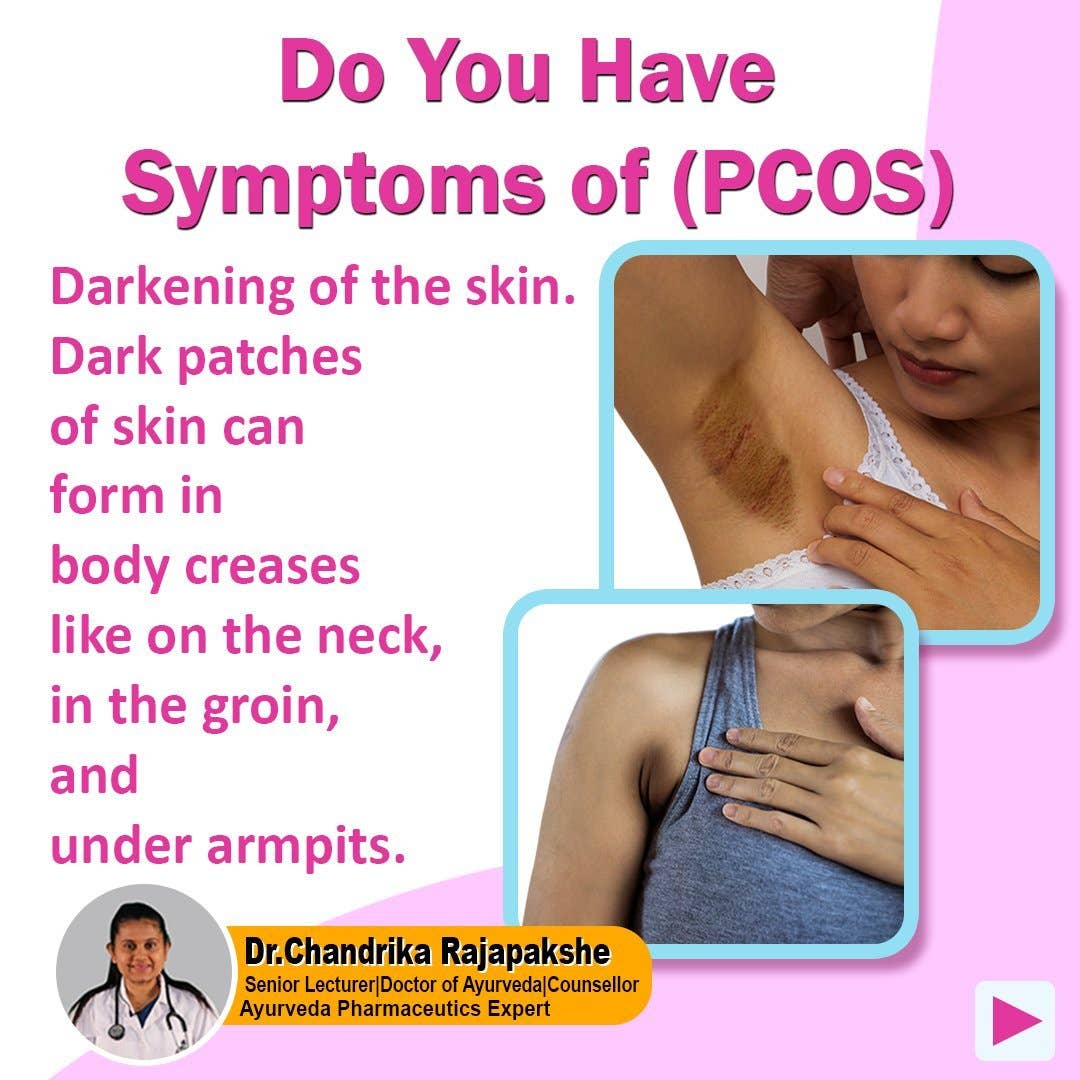 Secrets Of Tea - Wholesale Health/Detox Tea - Secrets Of Tea PCOS & PMS Be Gone Tea Support for Women - Symptom Relief, Mood, Acne, Skin darkens, and Menstrual Pain.1