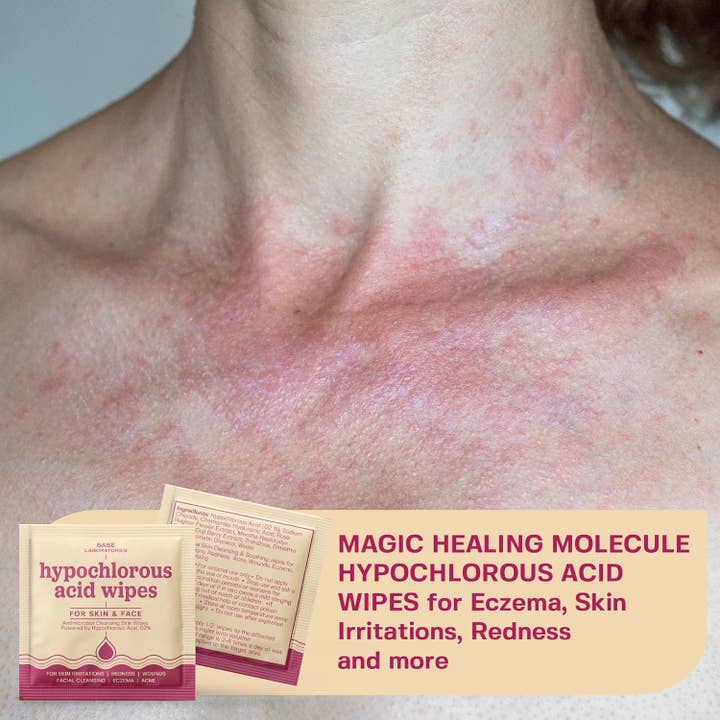 Base Laboratories - Wholesale Face & body wipes - Hypochlorous Acid Facial Wipes - Wound Cleaning Wipes2