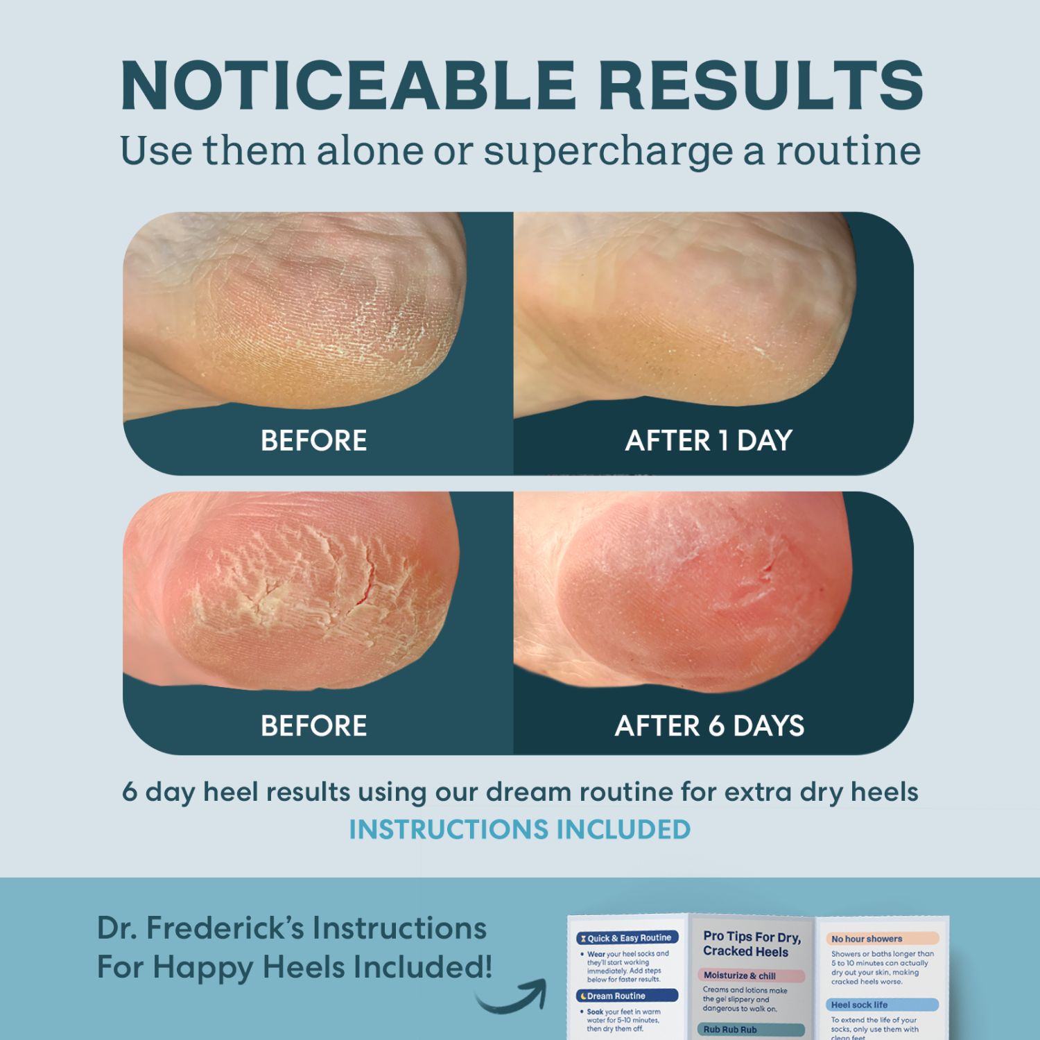 Dr. Frederick's Original - Wholesale Moisturizing Socks - Moisturizing Heel Socks - Fuzzy - 1 Pair - Teal Tranquility8