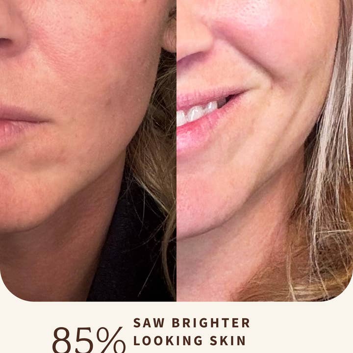 Bambu Earth LLC - Wholesale Facial Serum/Concentrate - Rosehip REPAIRING SERUM5