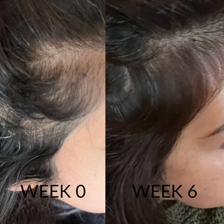 Hair Loving - Wholesale Hair Oil - Beauty Renewal - Nourishing Hair Growth for All Hair Types