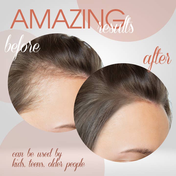 Au Natural Organics – Engroshandel Hårolie – Batanaolie 6oz krukke2