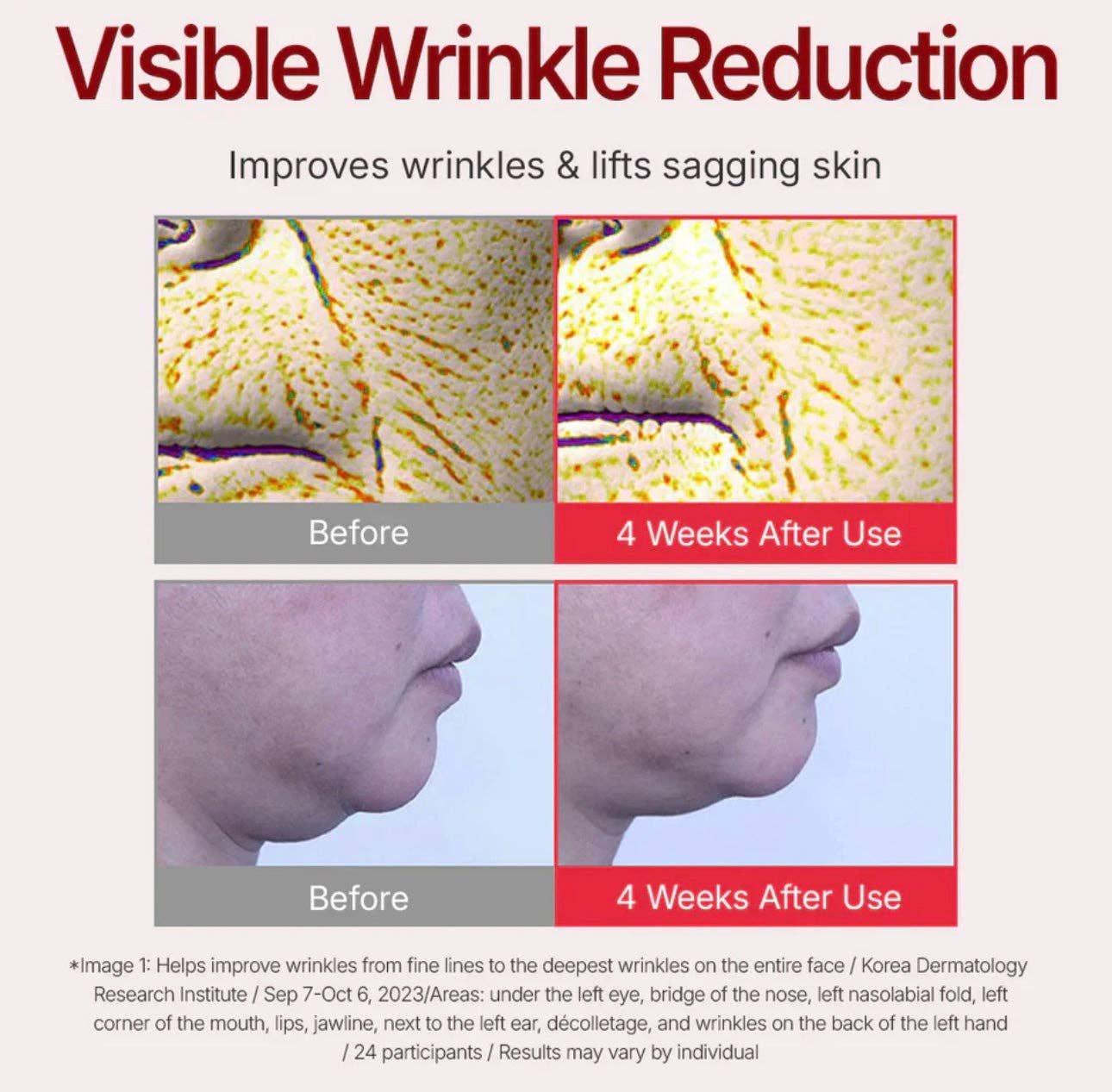 Beauty of Joseon, ANUA, COSRX, SKIN1004, Lilyfield - Wholesale Anti-Aging Moisturizer - Centellian24 Madeca Cream Time Reverse (50ml)2