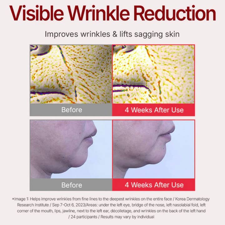 Beauty of Joseon, ANUA, COSRX, SKIN1004, Lilyfield - Wholesale Anti-Aging Moisturizer - Centellian24 Madeca Cream Time Reverse (50ml)2