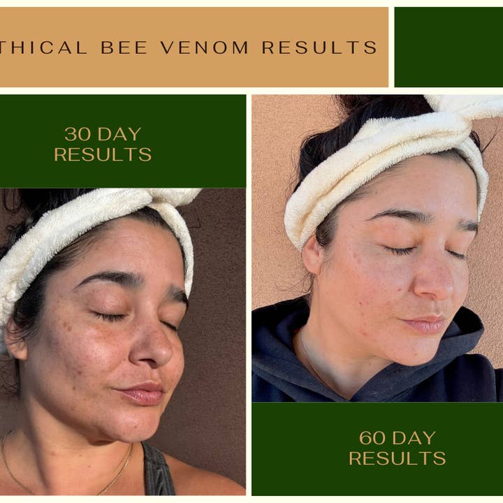 the.alambique - Wholesale Gezichtsserum/concentraat - de beste • bijengif • huidnectar •2