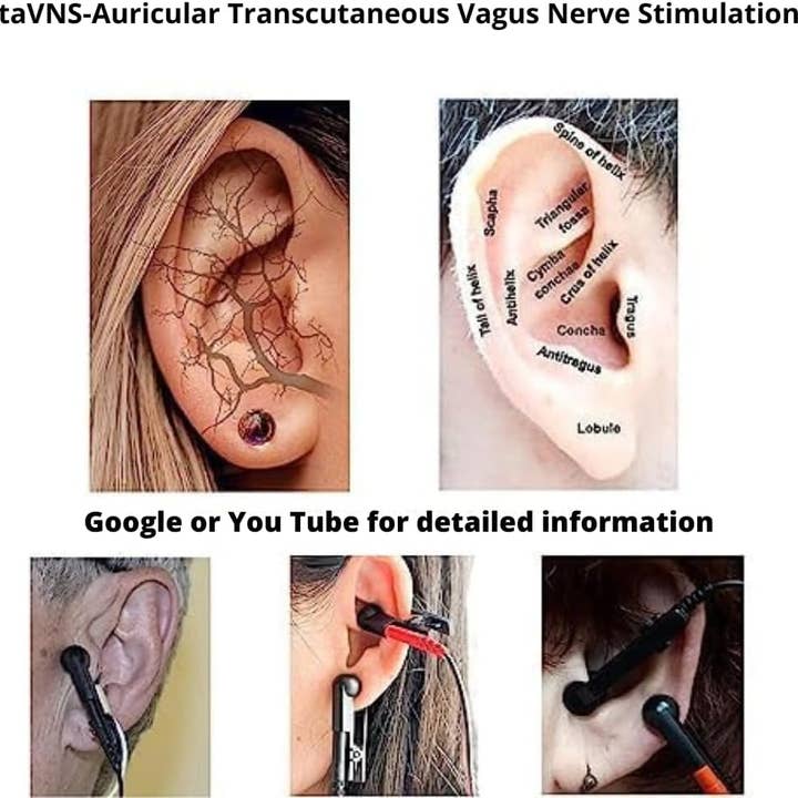 GoLiveAi - Wholesale Earplugs - Ear Clip Compatible with Vagus Nerve Device 2,5 mm Port 4