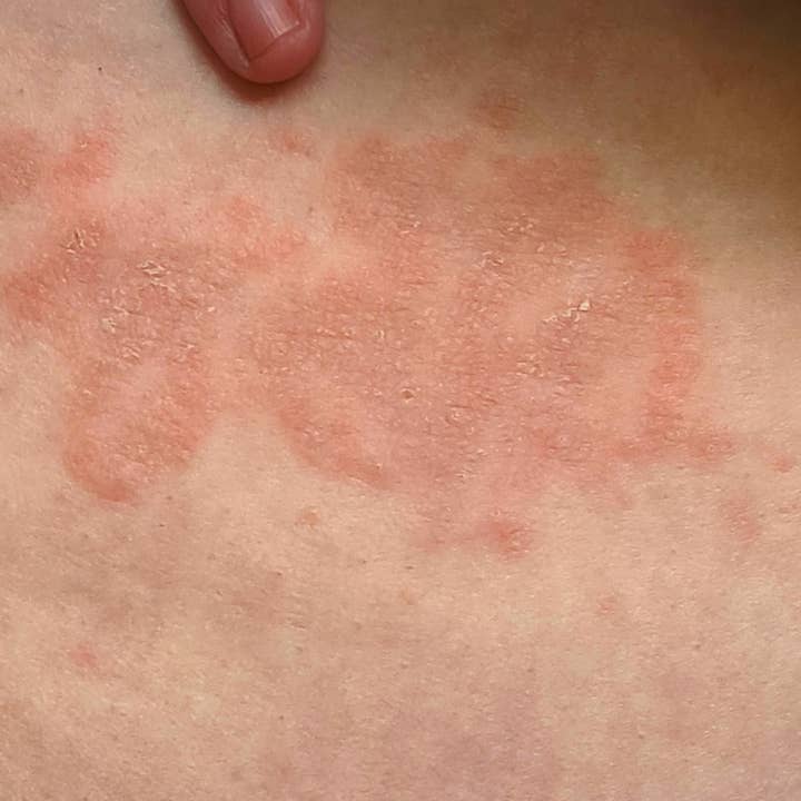 Nancy Natural Beauty Skincare - Vendita all'ingrosso Crema/lozione corpo - Sapone e crema naturali contro la tricofitosi4