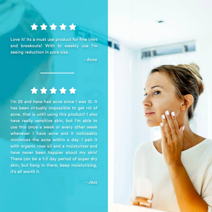 Perfect Image – wholesale Ansiktspeeling – Glykolsyra 50 % gelpeeling - nivå 25