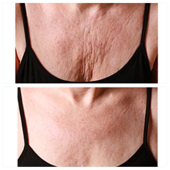 Kami Pure - Anti-Aging Silicone Gel Pads - Wholesale Skincare Face Mask - Wrinkle Recovery Chest Pad – Gift for Mom, Gift for Sister1