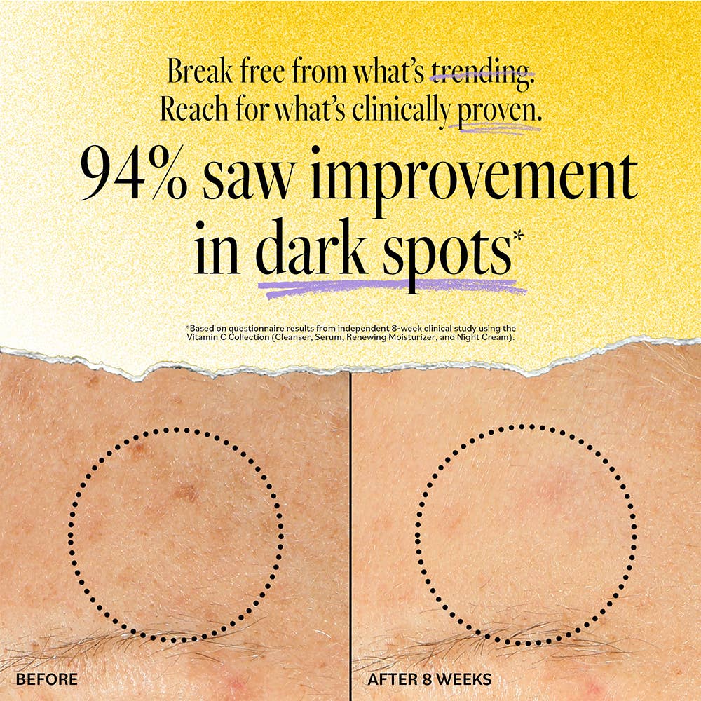 DERMA E - Wholesale Facial Serum/Concentrate - Vitamin C Concentrated Serum3