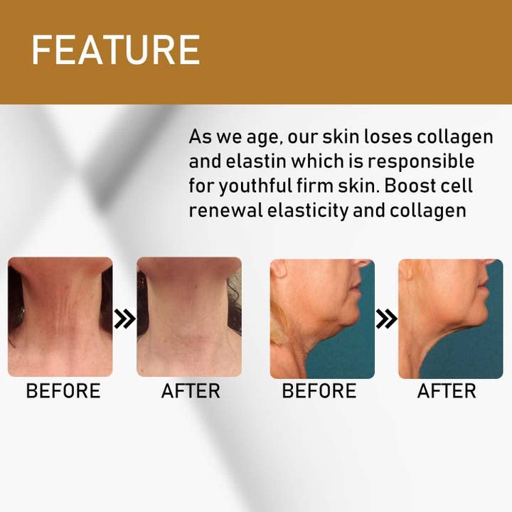 SlimSpa The Body Care Specialists - Wholesale Anti-Aging Moisturizer - Neck Firming & Double Chin Reducer Cream 8oz5