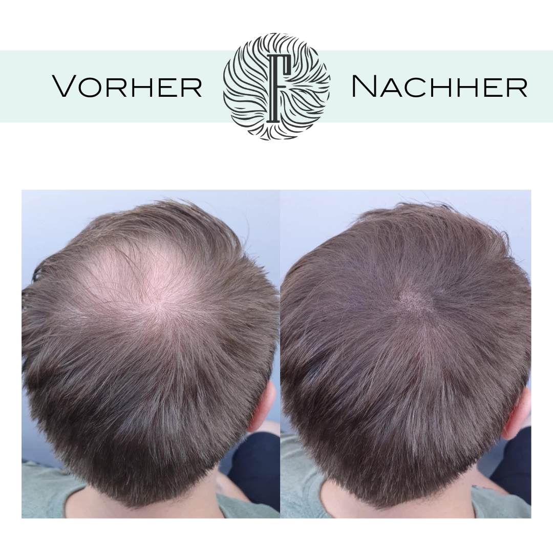 Fidentia Store - Wholesale Hair Dye - Fidentia hair shader - base powder thickens thin hair13