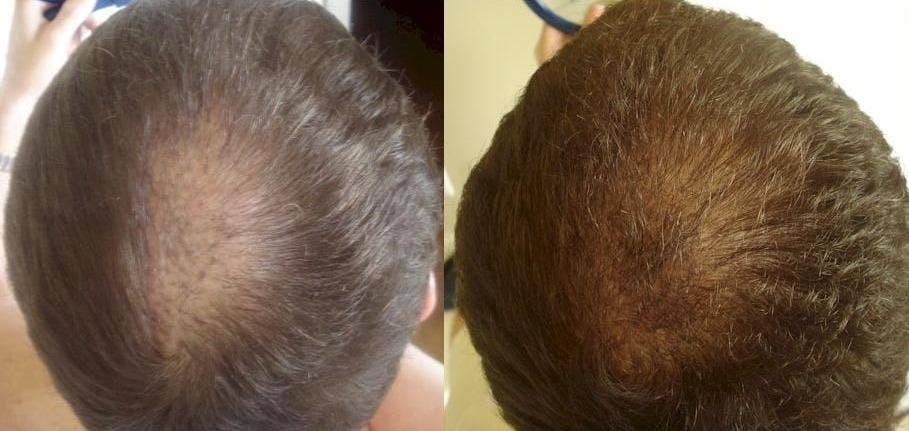 Hairresurrection - Wholesale Hair Oil - Intense Hair Growth Oil7