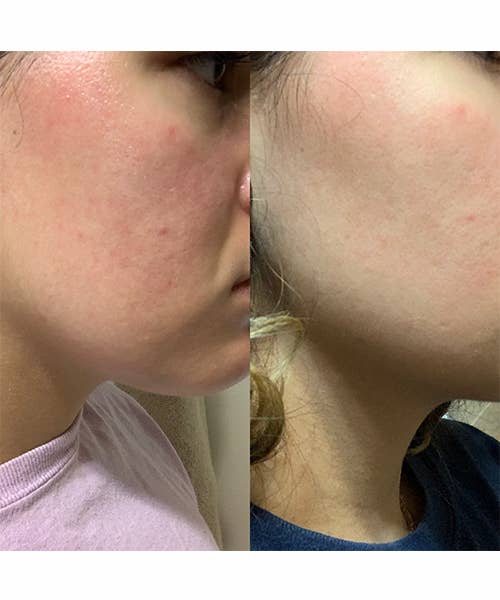 AcARRE - Wholesale Bath/Body Oil - Beauty Edit, Multi Use Treatment Oil3