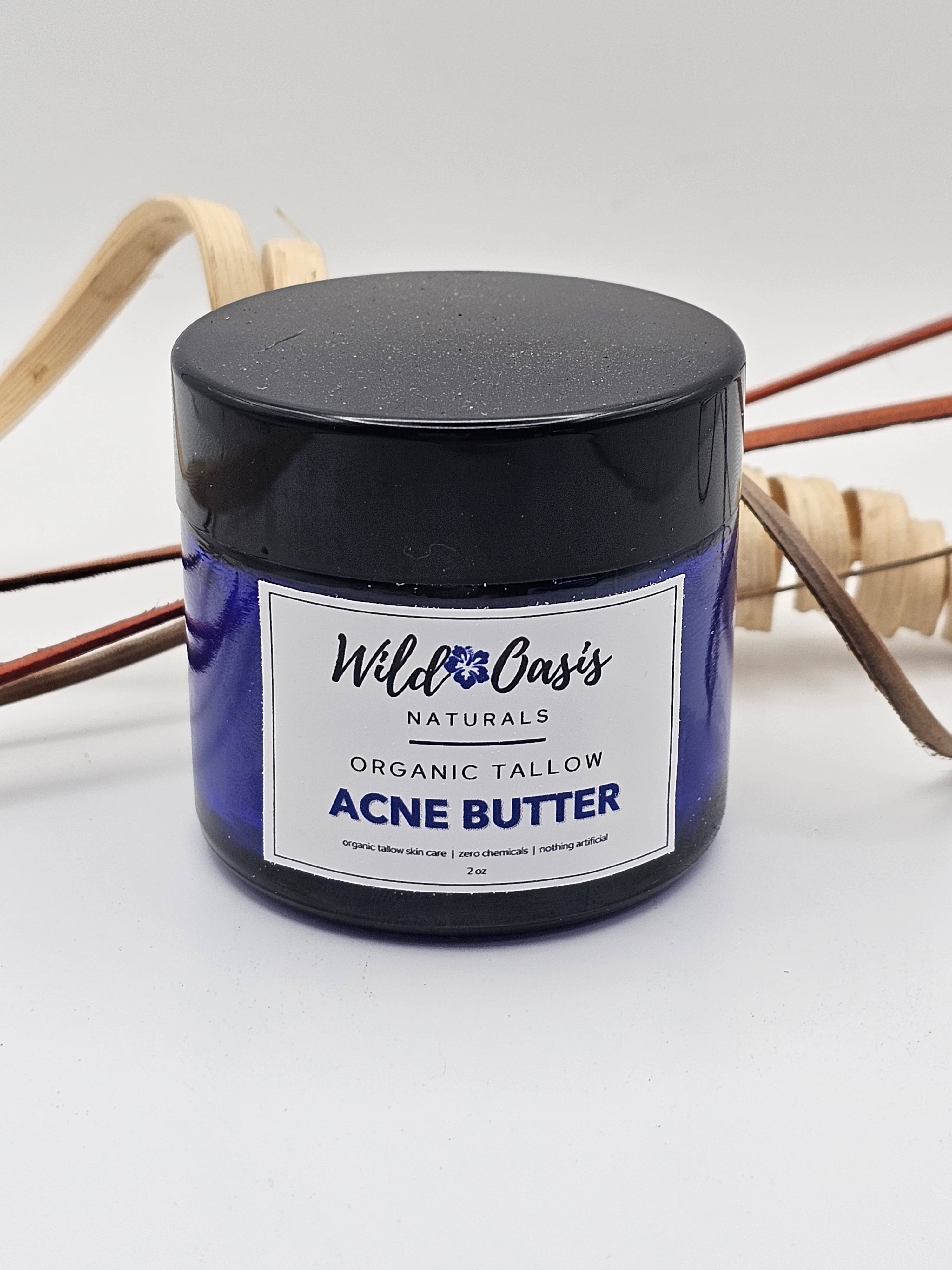 Wild Oasis Naturals - Wholesale Acne/Hydrocolloid Patch - Acne Butter - 2 oz - Organic Tallow Anti-Acne Cream2