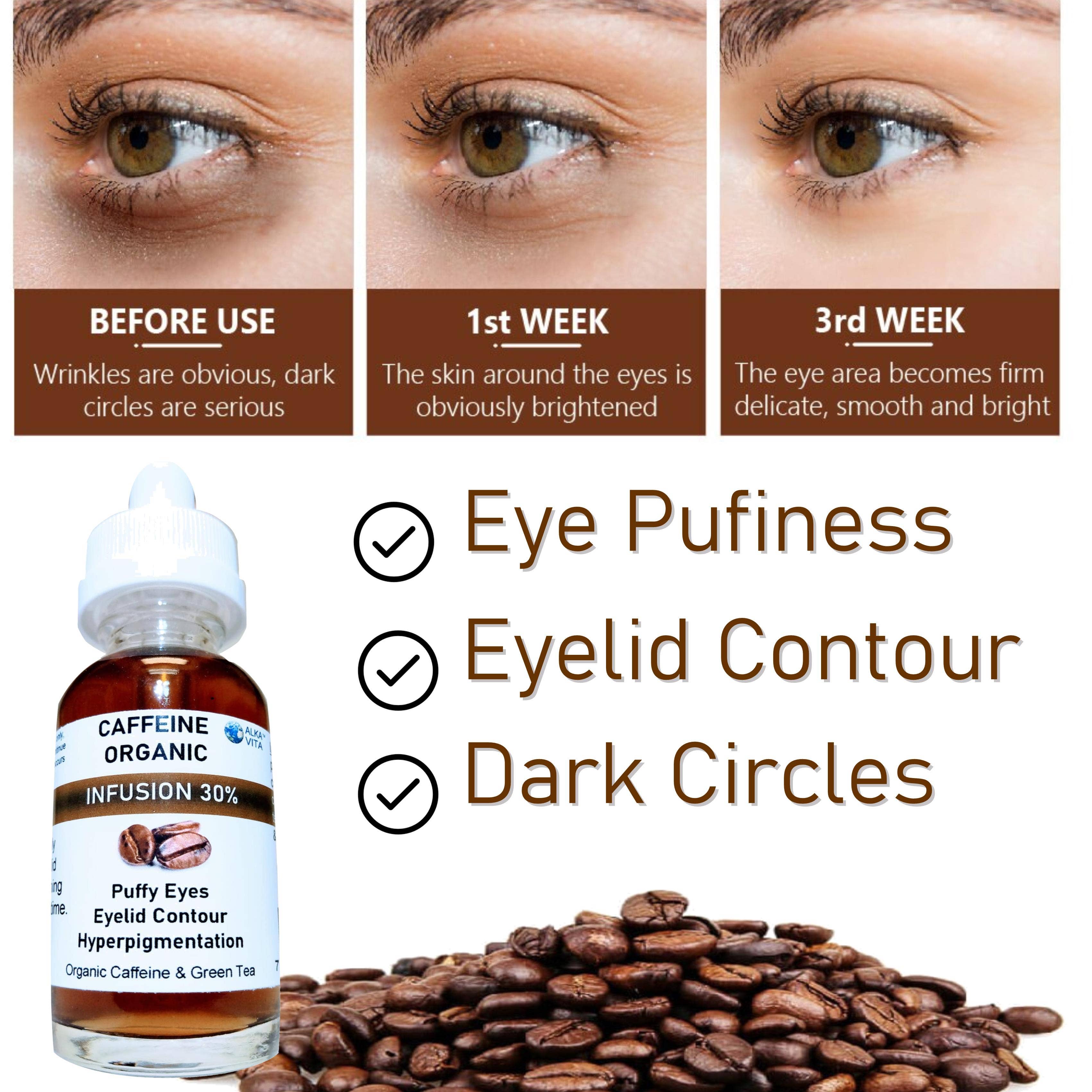 AlkaVita – wholesale Eye cream/gel – Puffy Eyes Caffeine 30% Infusion The Highest Concentration3