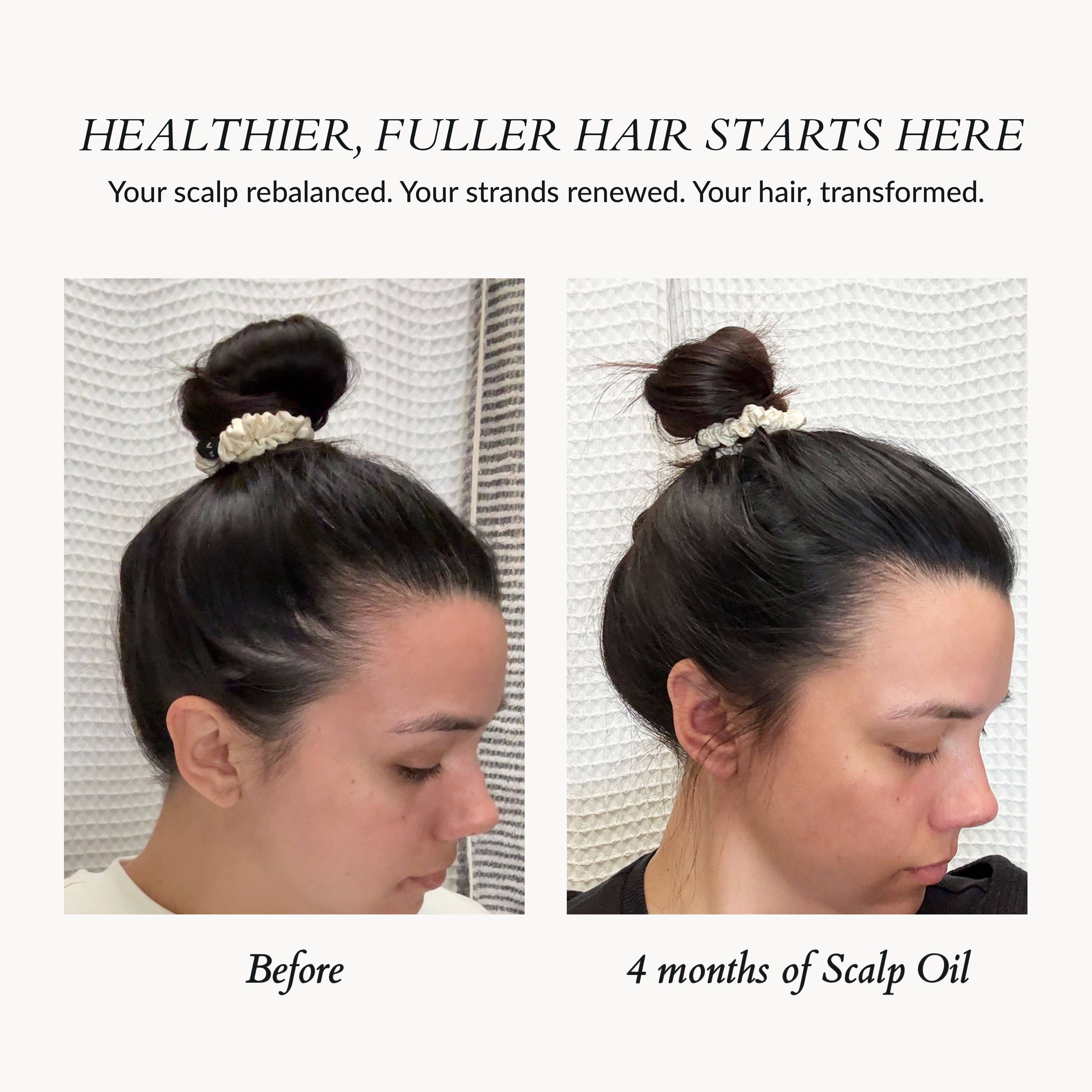 Jazeena - Wholesale Scalp/Hair Treatment - Hair Strengthening Scalp Oil | Rosemary, Magnolia Bark 55ml3