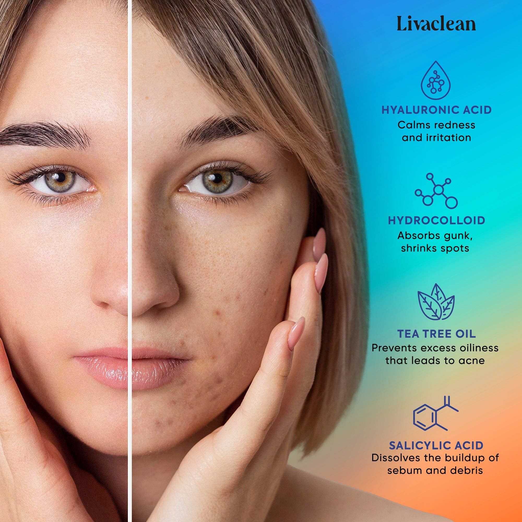Livaclean - Vente Patch contre l'acné/hydrocolloïde - Patchs anti-boutons à micro-aiguilles 18 ct Patch hydrocolloïde Traitement des imperfections5