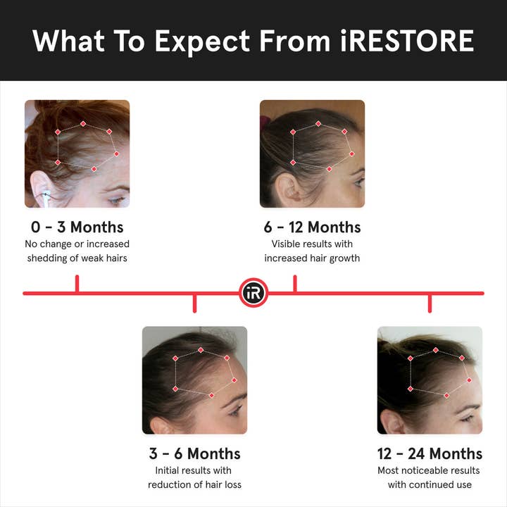iRESTORE - Wholesale Scalp/Hair Treatment - iRESTORE PRO Laser Red Light Therapy Hair Growth5