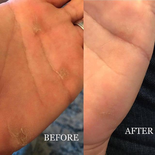 Callus Performance – wholesale Läkande salva/balsam/kräm – Förhårdnadsläkande salva - Mynta med eukalyptus