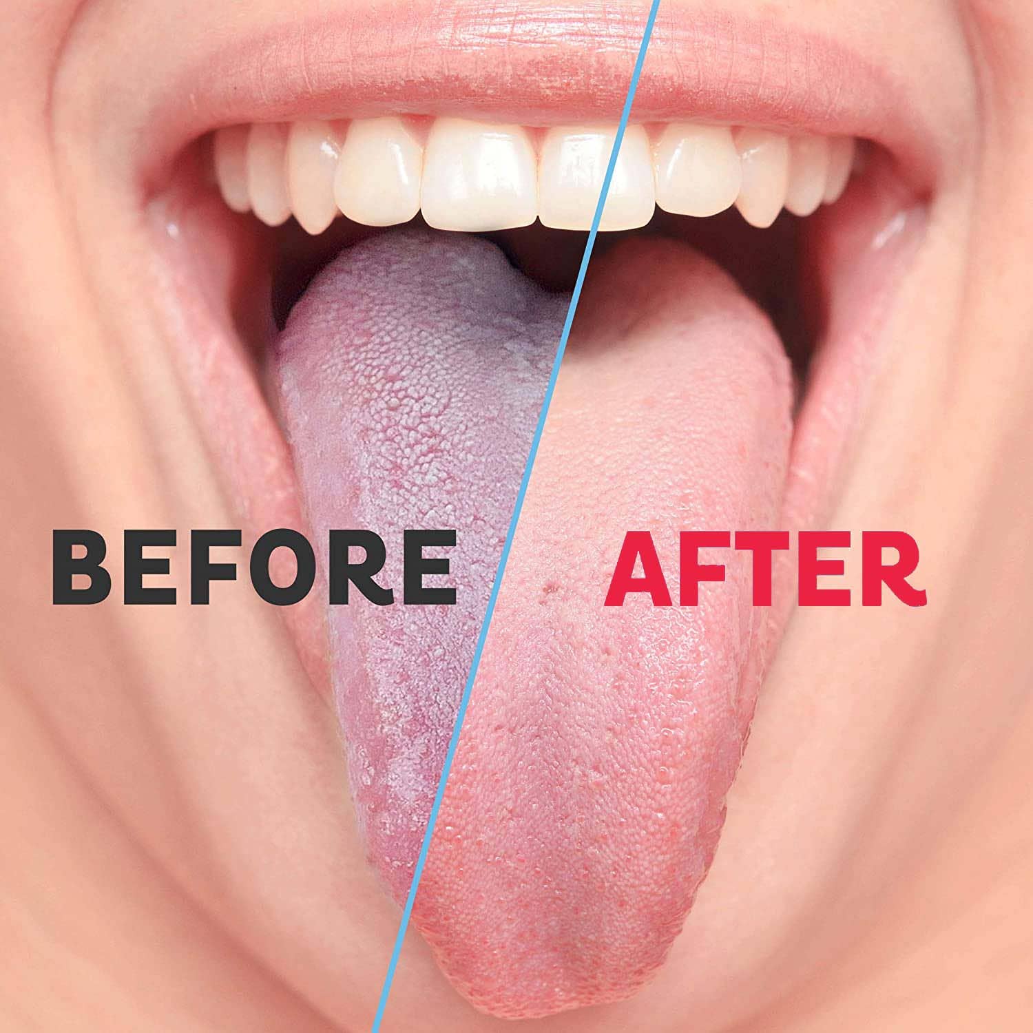 Metal Products – wholesale Tungskrapa – Tungskrapa, Minska dålig andedräkt Medical Grade, Rostfritt stål tunga rengöringsmedel, Metal Tounge Scrappers, Tungskrapa Cleaner för frisk andedräkt5