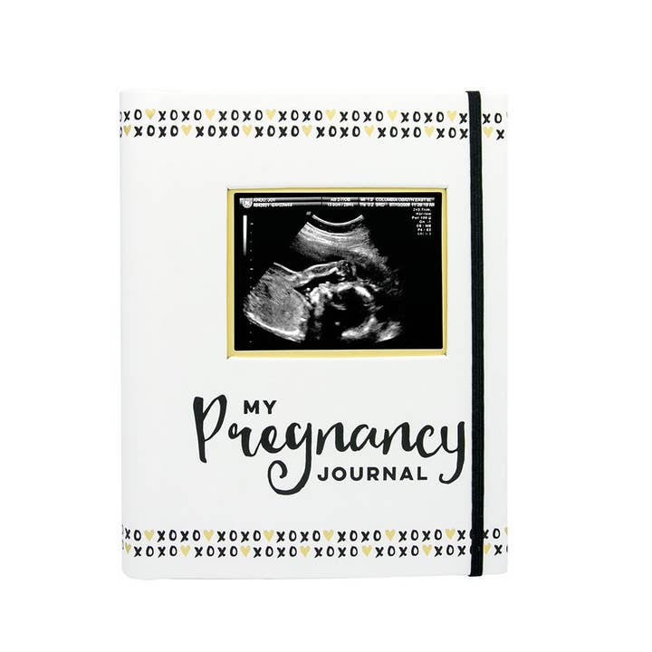 Pearhead - Wholesale Journal/Diary - Maternity - Pregnancy Journal, Black White & Gold