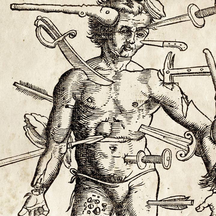 Curious Prints - Wholesale Art Print - Vintage Anatomy Wounded Man Print w/ optional frame1