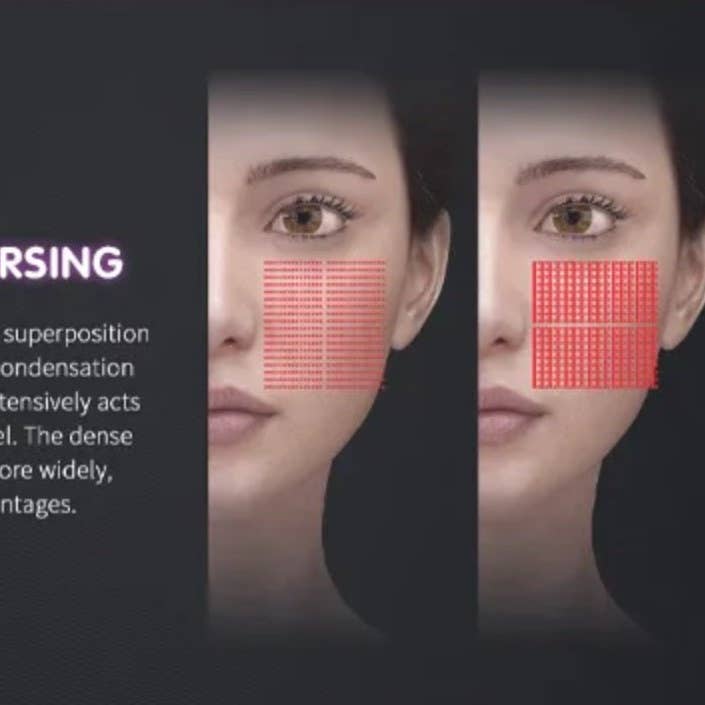 Cavitation Machines - Wholesale Electronic Skincare Device - Shape Tactics Advanced 3-Handle Dual Control 12D HIFU System15